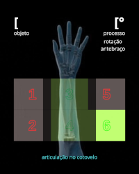 rotação antebraço ([°)